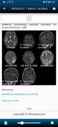 MRI MASTER - планинг МРТ